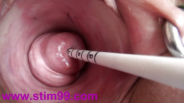 青少年组005短的阴茎的图片。 虐我自己的暨免费的视频黑贫民窟的阴部